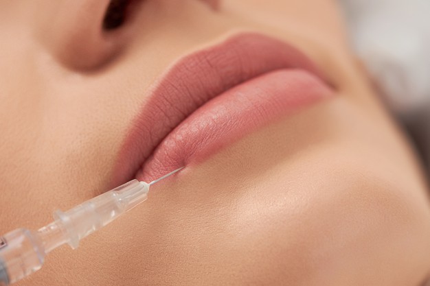 Видео о процедуре увеличение губ гиалуроновой кислотой | Видео клиники Vitaura