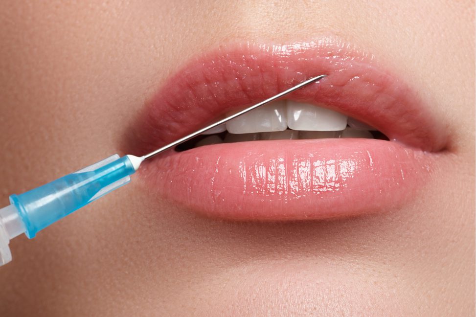 7 проверенных способов увеличить губы без уколов