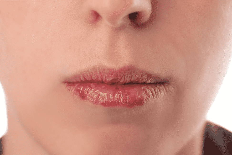Сухие губы у ребёнка: причины и деликатный уход