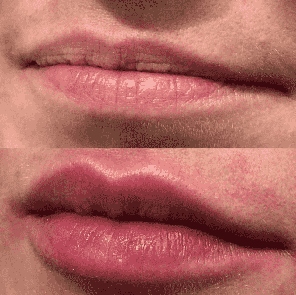 Как вылечить потрескавшиеся губы (с иллюстрациями)
